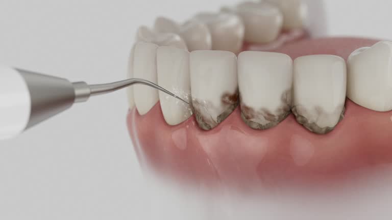 Reliable Dental Implants contractor in Destin, FL by Smile Center Dentistry